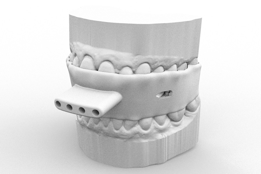 Oral device render